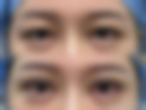 田超诊疗的