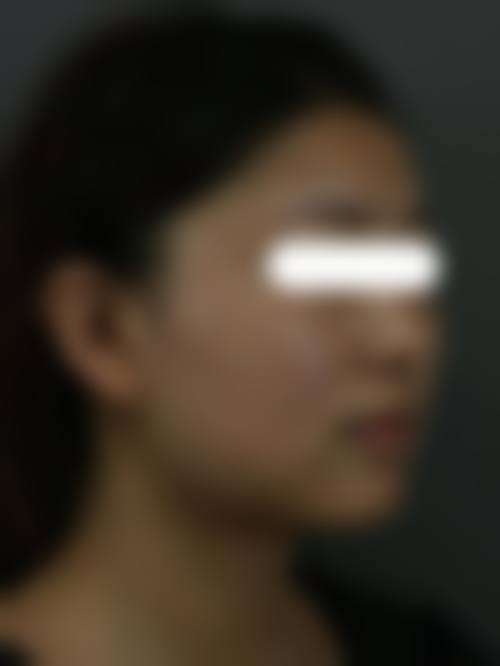 通辽迪尔美和医疗美容整形门诊部求美者反馈
