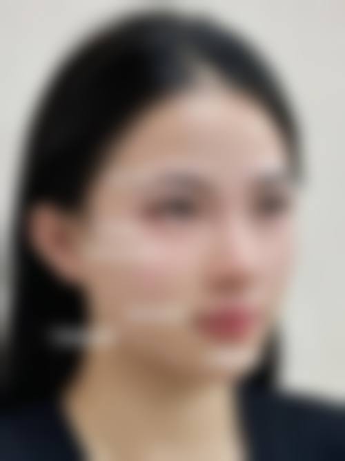 徐晓婷院长坚持的私人订制医美理念
