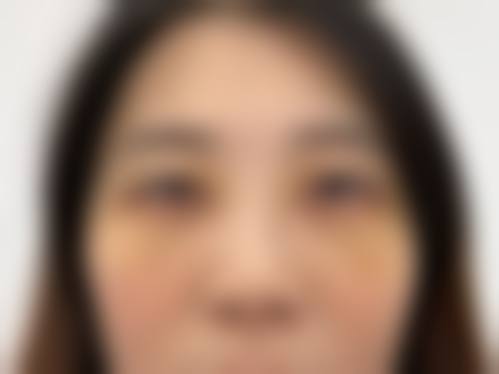 徐州心源整形美容医院价格收费