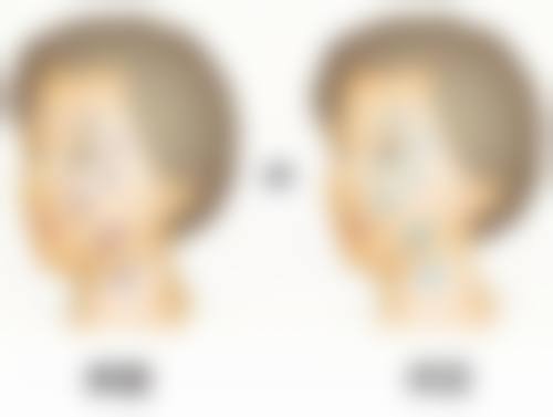 武汉领秀植发医院价格收费
