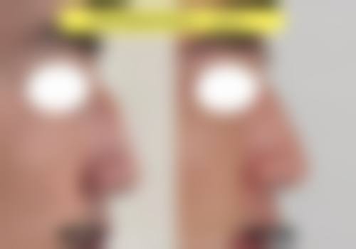 株洲唐文斌医疗美容门诊部求美者反馈