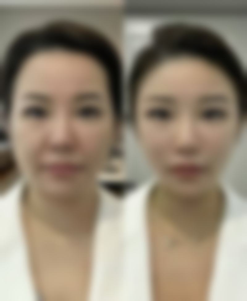 武汉领秀植发医院求美者反馈