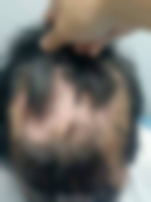 阳威医师诊疗的透明收费标准