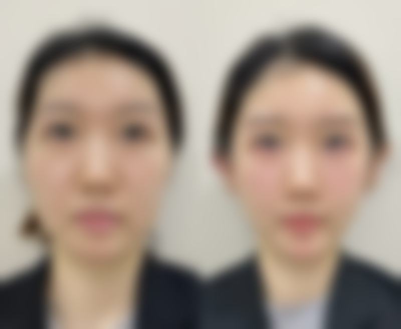新疆医瑞国内外整形中 心求美者反馈