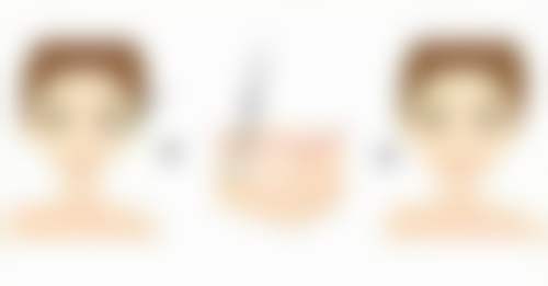 黄艺贤医生的预约与就诊指引