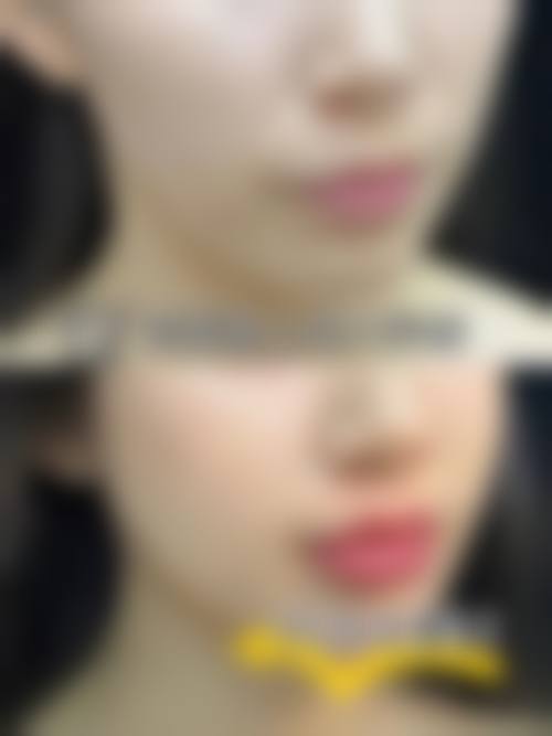 临沂盖娅医疗美容门诊部求美者反馈