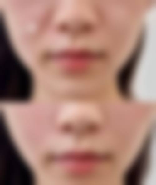 苏州星拾光医疗美容门诊部价格收费