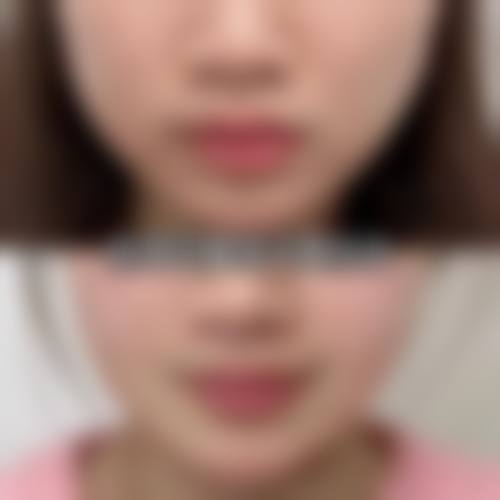苏州星拾光医疗美容门诊部求美者反馈