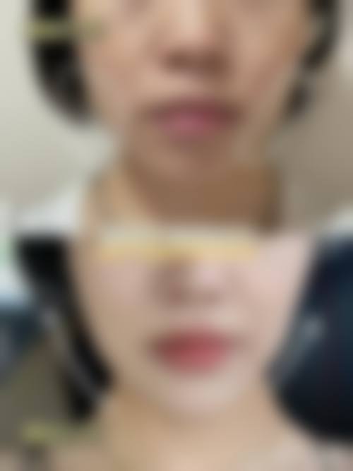 湖北汀恩医疗美容价格收费