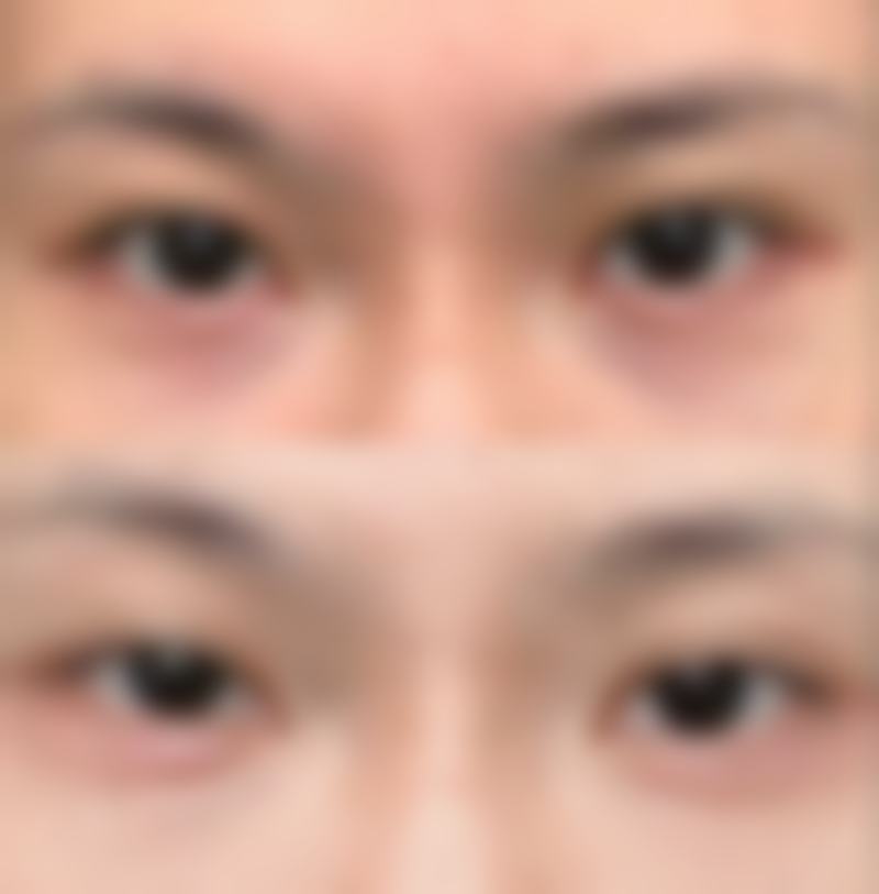 韩国Glowell整形医院来院路线