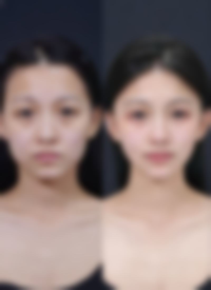 深圳广和尹骨干医生整形美容医院价格收费