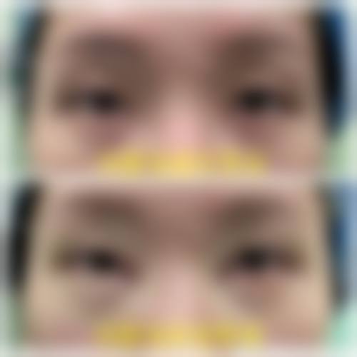 冯利光的手术理念与安心准则