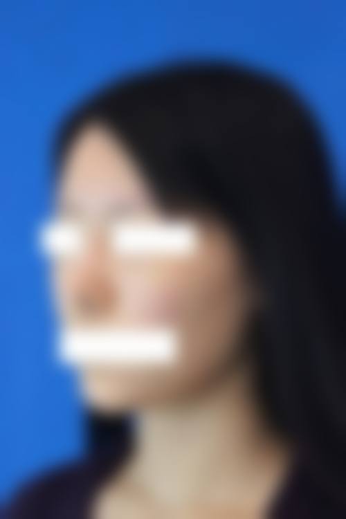 广州利美康医疗美容门诊部特色项目及技术优势