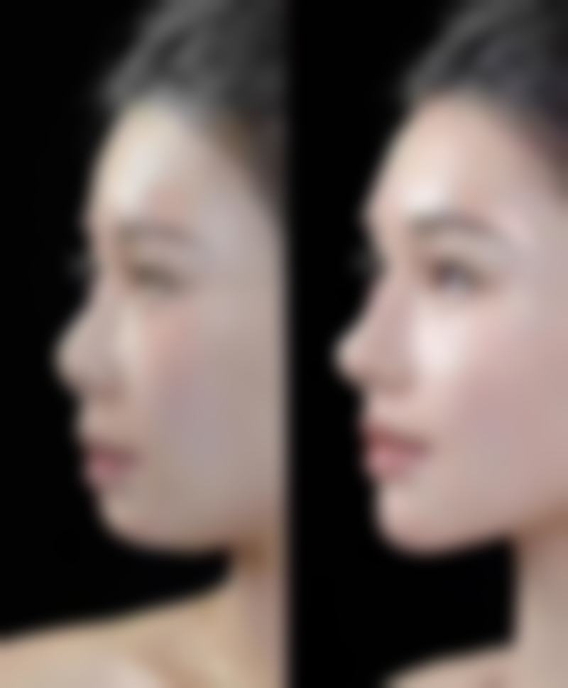 成都美黎美医疗美容整形门诊部特色项目及技术优势