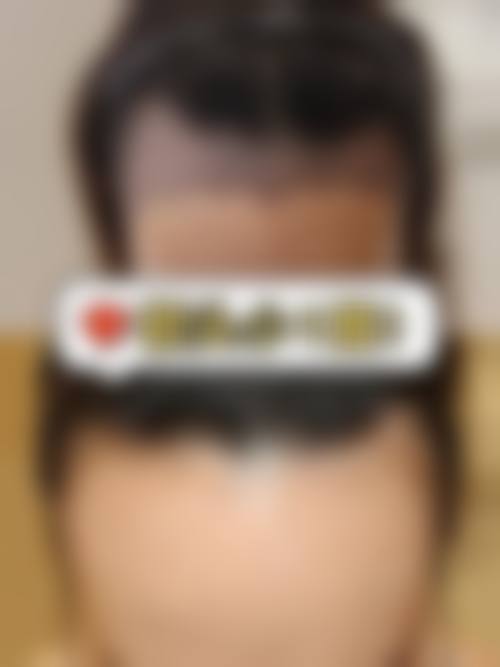 丹阳恒美医疗美容门诊部求美者反馈