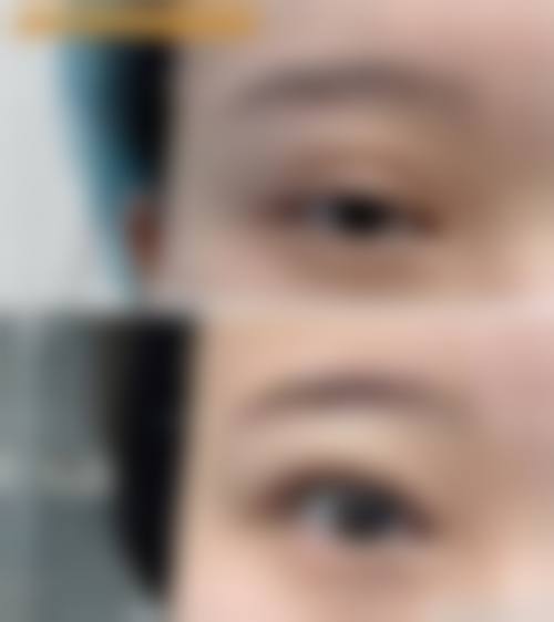 濮阳缔莱美医疗美容门诊部求美者反馈