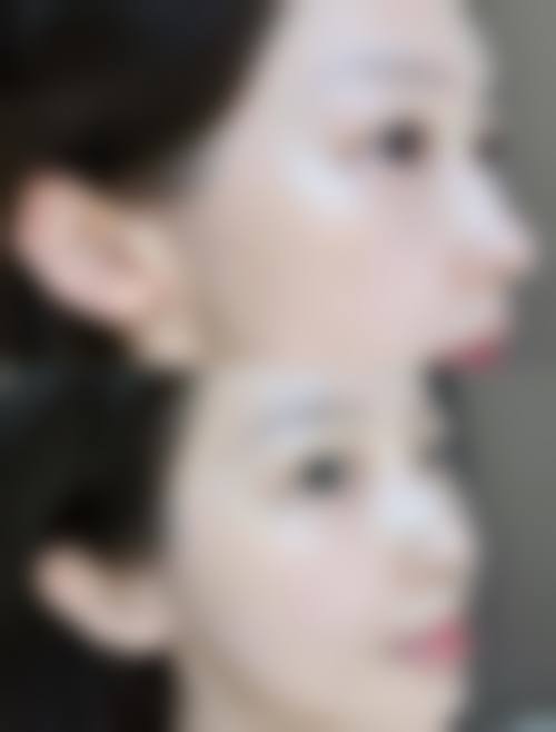 怀宁姬妍整形医院价格收费