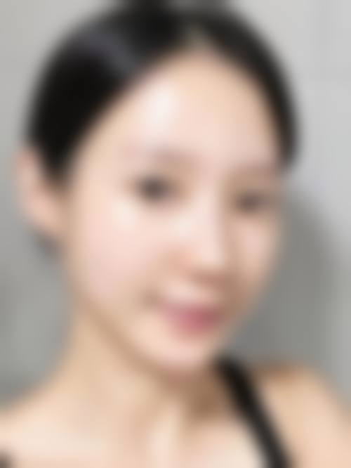 烟台星范整形医疗美容医院求美者反馈