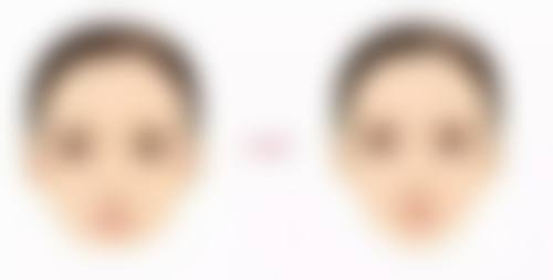 杭州4ever医疗美容门诊部特色项目及技术优势