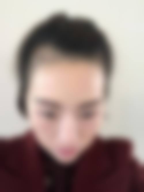 德州圣韩美整形美容医院价格收费