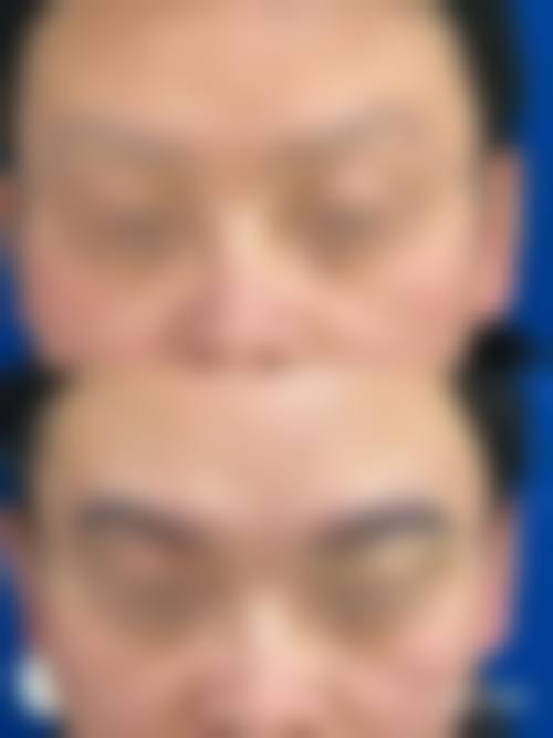 赵延华医美服务的安心体验