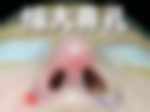 石晓贤的个性化医美定制理念