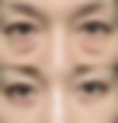 山西阳泉市美亚医学整形美容诊所求美者反馈