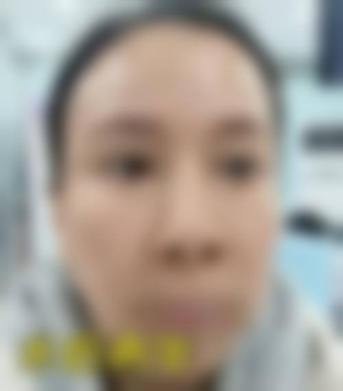 李越的医美服务理念:安心与美观并重