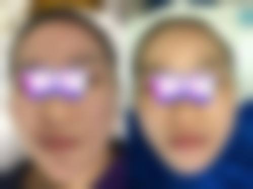 凯恩医生的个性化美丽定制理念