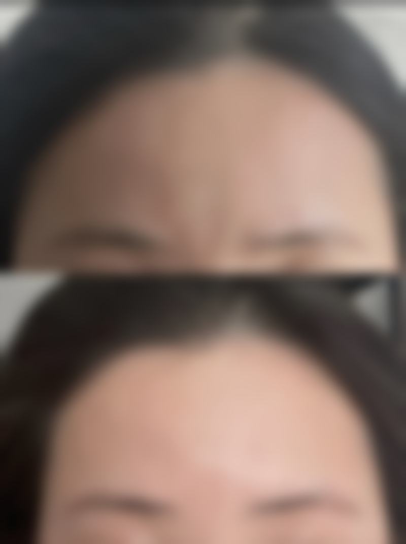 承德美天整形医疗美容医院价格收费