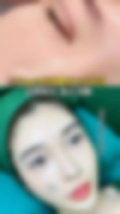 林中梅可参与开展的医美项目全方面覆盖