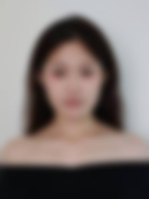 绍兴上虞亚韩医疗美容诊所求美者反馈