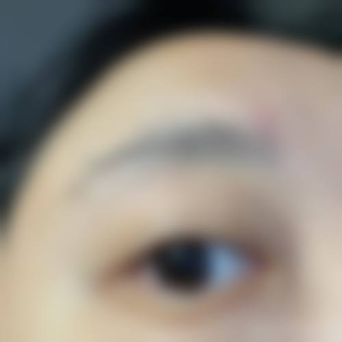 任亮医生使用的特色塑美技术