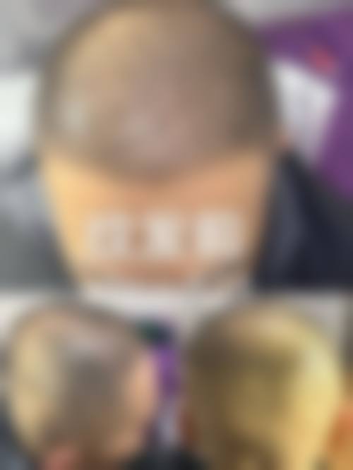 预约黄兆全医师毛发诊疗的便捷方式