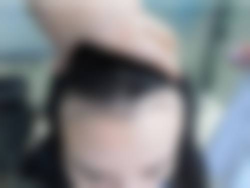 黄兆全医师的个性化毛发诊疗服务