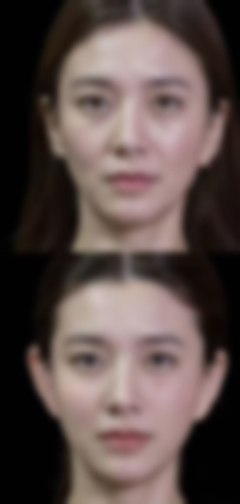 重庆张瑜整形医疗美容求美者反馈