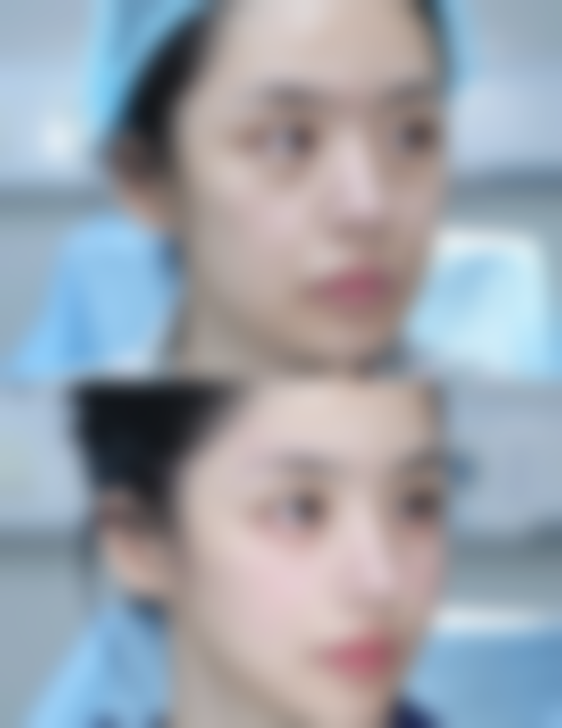 泉州优美甄美医疗美容门诊部特色项目及技术优势
