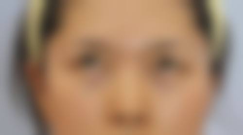 上海市第七人民医院烧伤整形科口碑怎么样