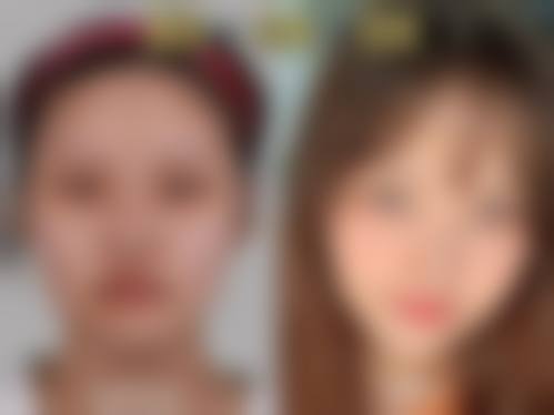 郑州一美丽人医疗美容门诊部怎么样预约挂号