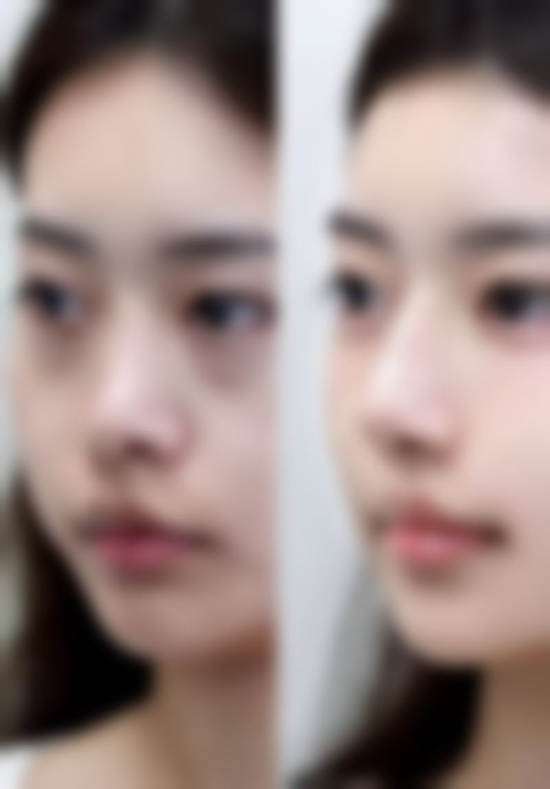为什么要选择郑州一美丽人医疗美容门诊部?