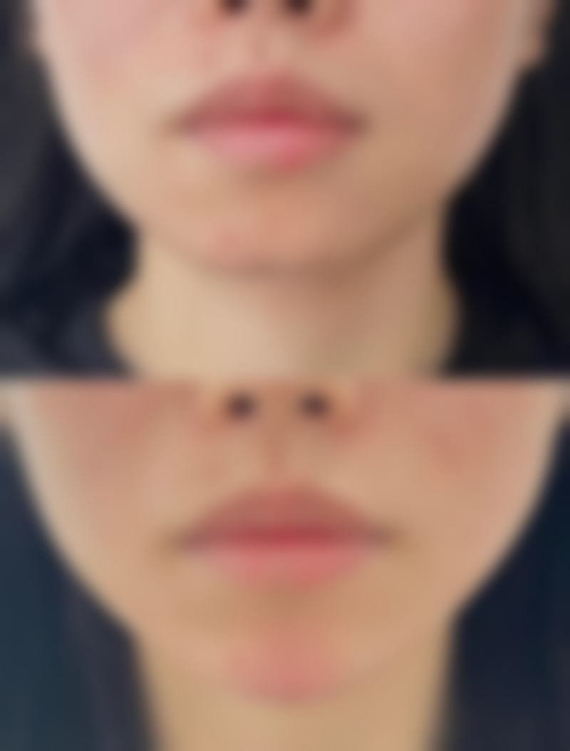 呼和浩特闫小林医疗美容门诊部是正规的吗
