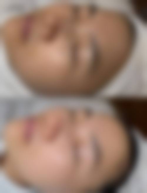 台州新凤凰医疗美容门诊部口碑怎么样