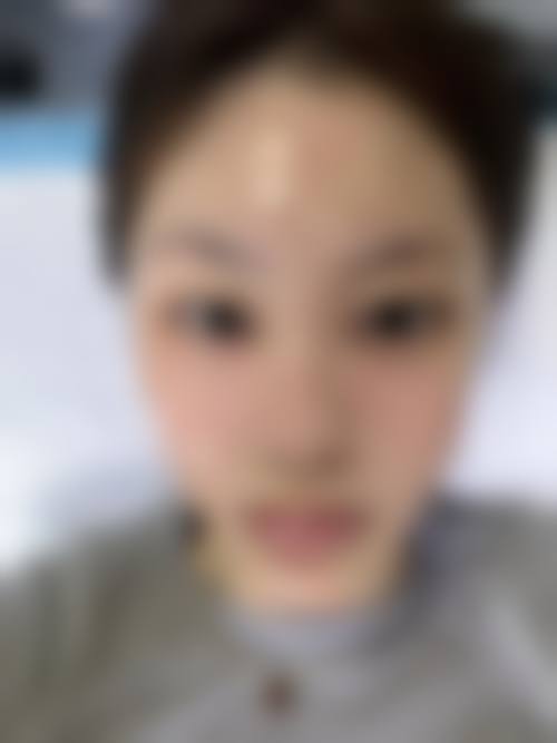 开封市汴美整形医院是正规的吗