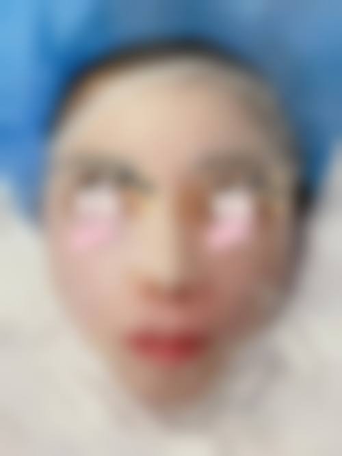 成都星尚美医疗美容门诊部是正规的吗