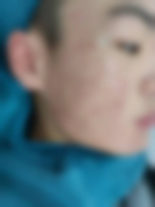 为什么要选择宜宾悦她婕熹卡医疗美容门诊部?