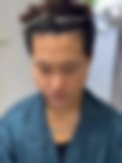 无锡青云植发口碑怎么样