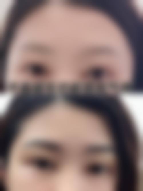 无锡青云植发是正规的吗
