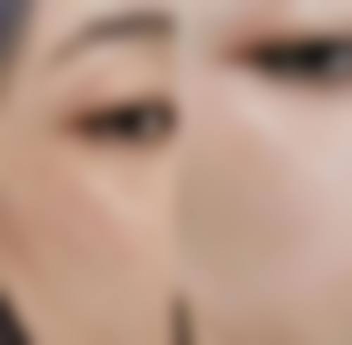 邢俊兰的临床实战与真实实例