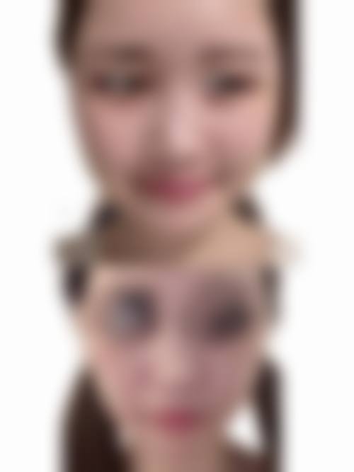 3. 刘文明的临床实战与真实实例
